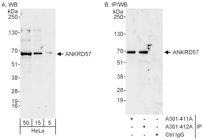 ANKRD57 Antibody in Western Blot (WB)