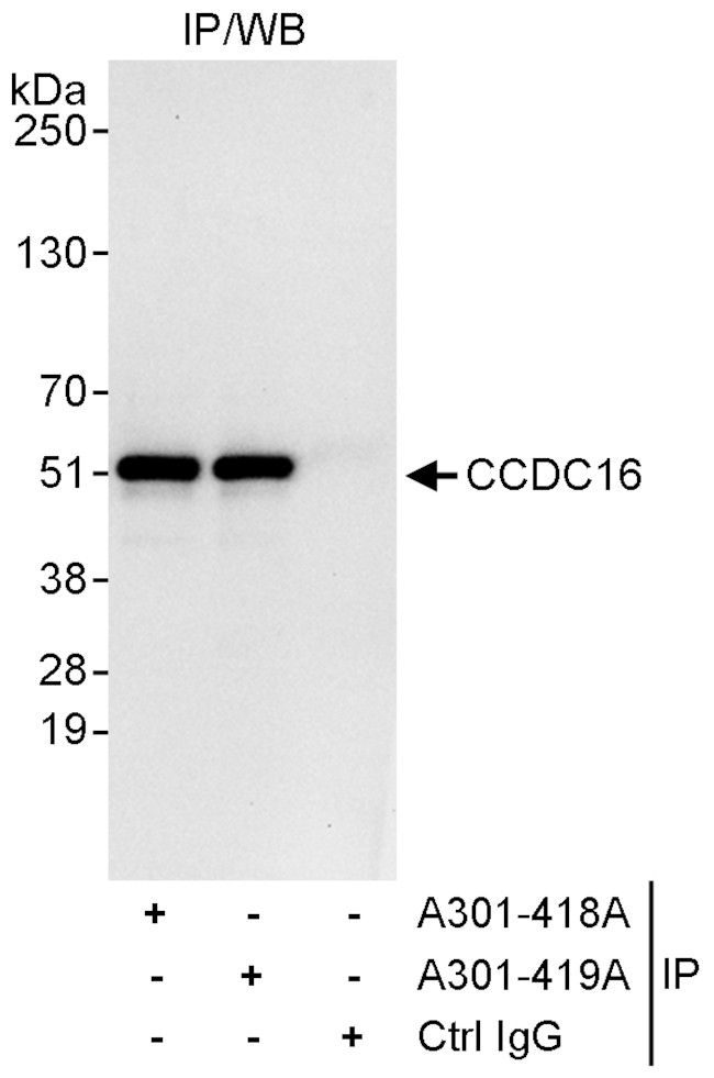CCDC16 Antibody in Immunoprecipitation (IP)