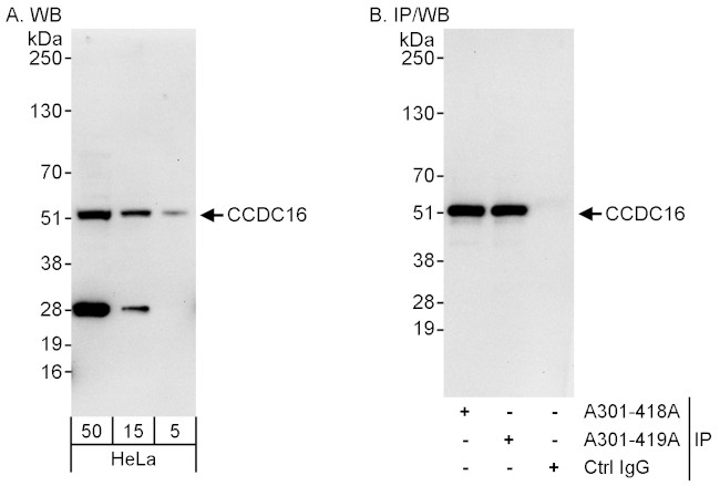 CCDC16 Antibody in Western Blot (WB)