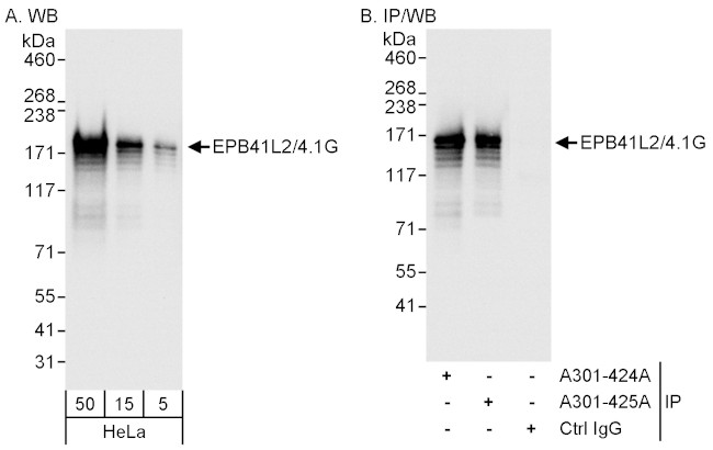 EPB41L2/4.1G Antibody in Western Blot (WB)