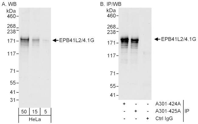 EPB41L2/4.1G Antibody in Western Blot (WB)