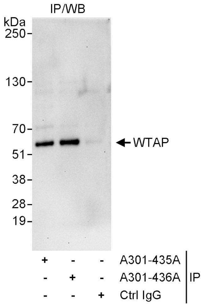 WTAP Antibody in Immunoprecipitation (IP)