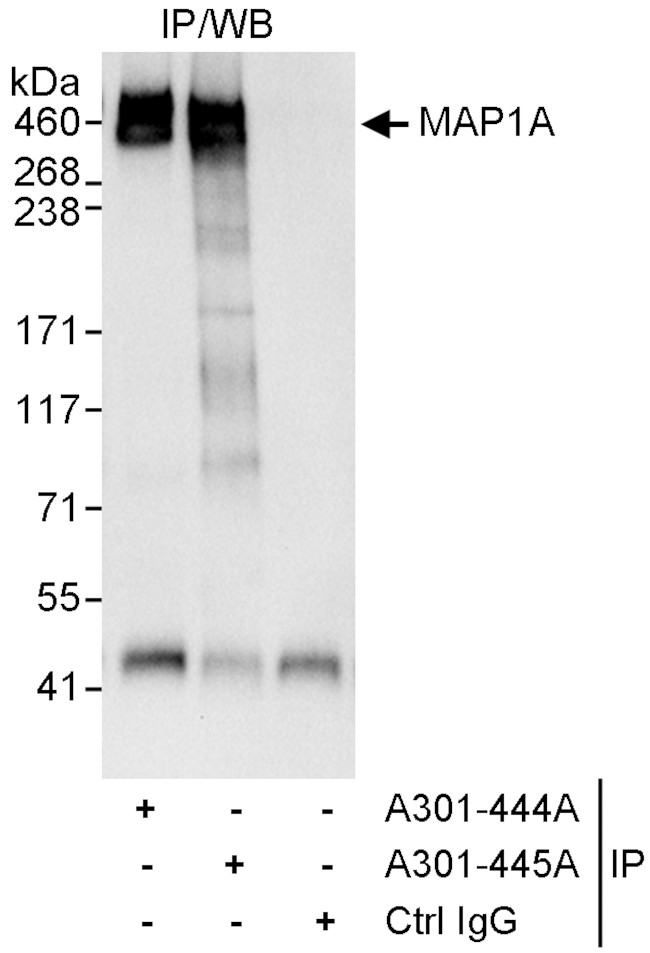MAP1A Antibody in Immunoprecipitation (IP)