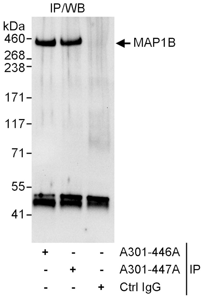 MAP1B Antibody in Immunoprecipitation (IP)