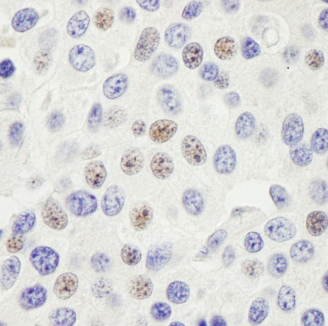 PHF6 Antibody in Immunohistochemistry (Paraffin) (IHC (P))