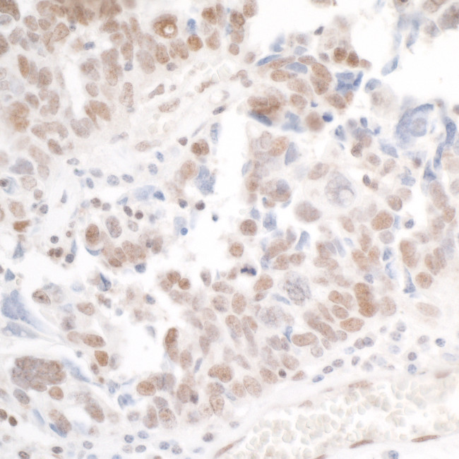 PHF6 Antibody in Immunohistochemistry (Paraffin) (IHC (P))