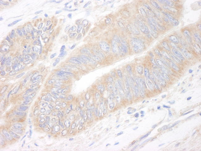 CIP2A Antibody in Immunohistochemistry (Paraffin) (IHC (P))