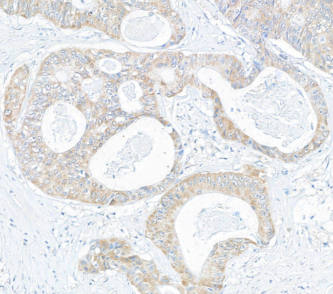 CIP2A Antibody in Immunohistochemistry (Paraffin) (IHC (P))