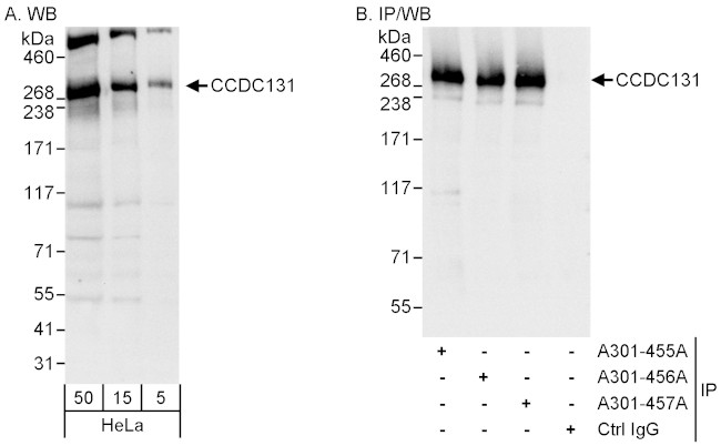 CCDC131 Antibody in Western Blot (WB)
