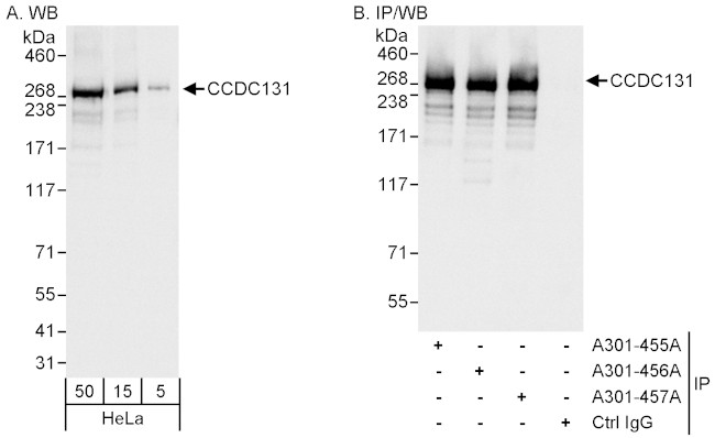CCDC131 Antibody in Western Blot (WB)
