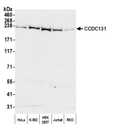 CCDC131 Antibody in Western Blot (WB)