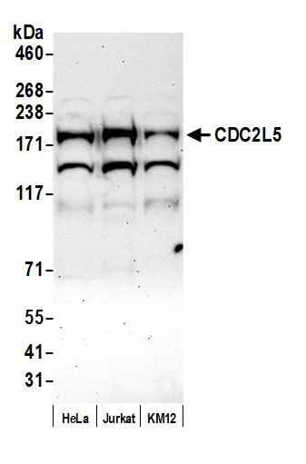 CDC2L5 Antibody in Western Blot (WB)