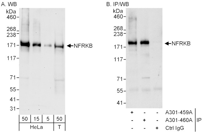 NFRKB Antibody in Western Blot (WB)