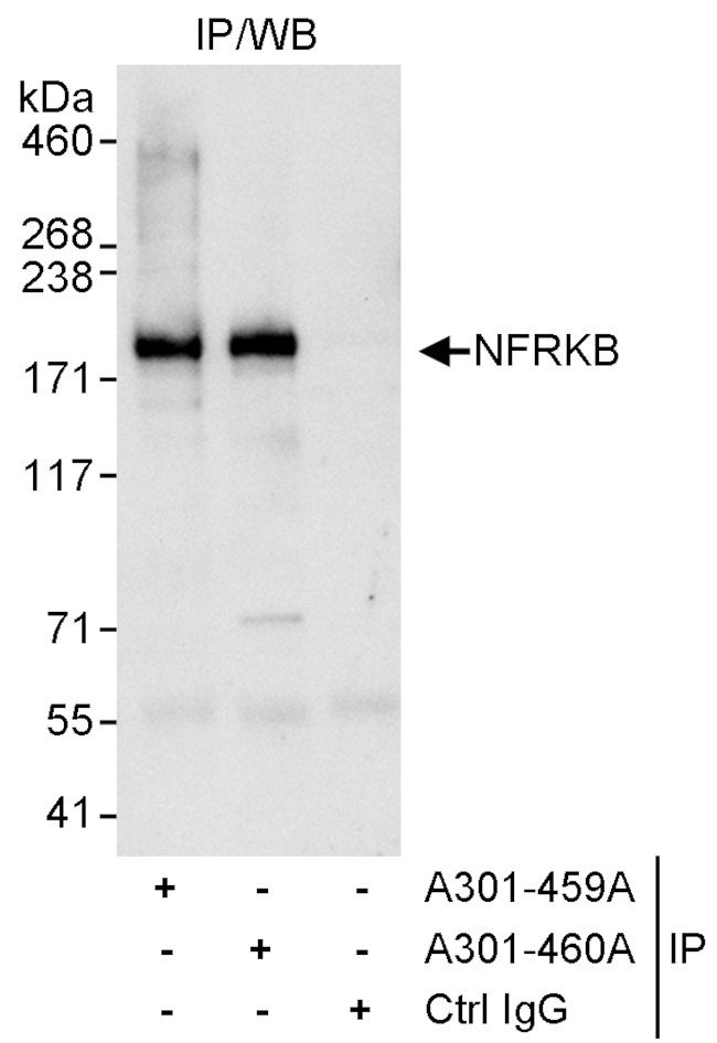 NFRKB Antibody in Immunoprecipitation (IP)