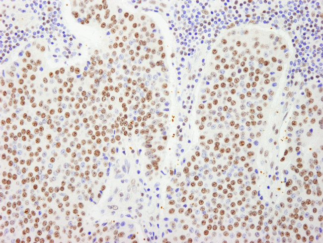 FIP1 Antibody in Immunohistochemistry (Paraffin) (IHC (P))