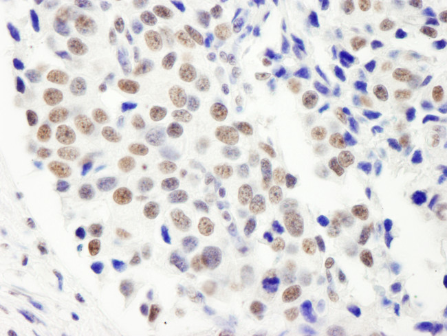 FIP1 Antibody in Immunohistochemistry (Paraffin) (IHC (P))