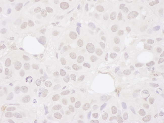Symplekin Antibody in Immunohistochemistry (Paraffin) (IHC (P))