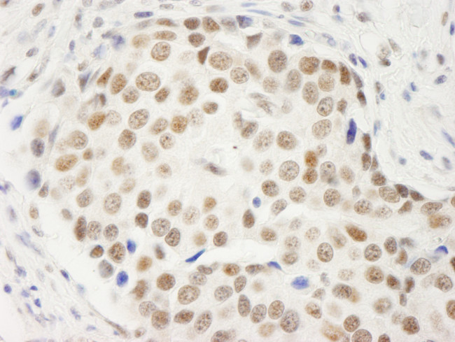 Symplekin Antibody in Immunohistochemistry (Paraffin) (IHC (P))