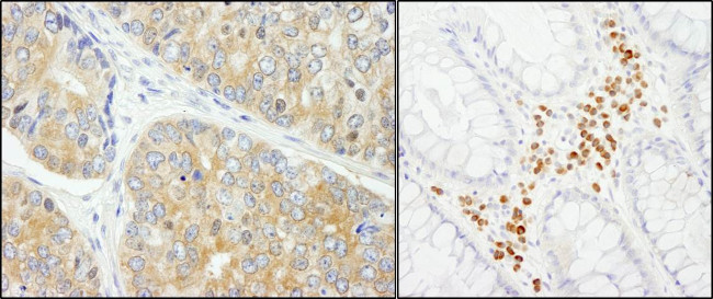 PABP4 Antibody in Immunohistochemistry (Paraffin) (IHC (P))