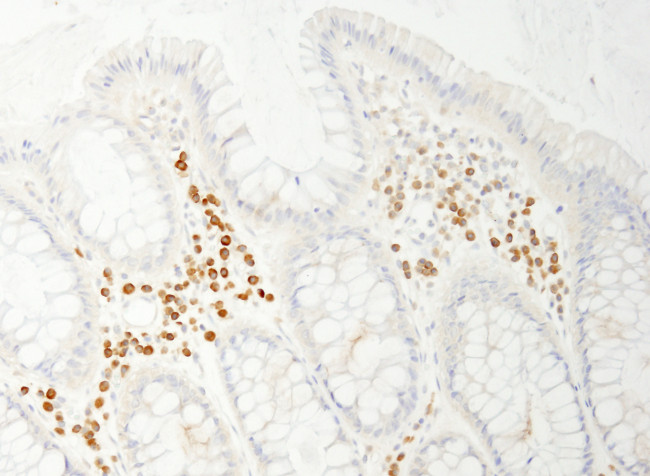 PABP4 Antibody in Immunohistochemistry (Paraffin) (IHC (P))
