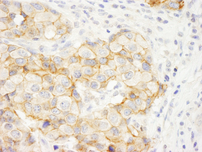 KIAA0528 Antibody in Immunohistochemistry (Paraffin) (IHC (P))