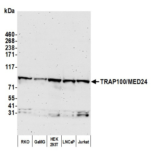 TRAP100/MED24 Antibody in Western Blot (WB)