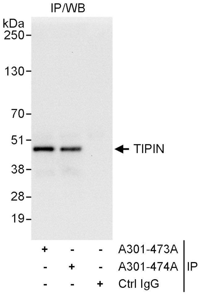 TIPIN Antibody in Immunoprecipitation (IP)