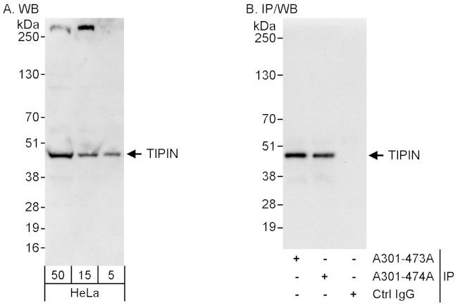 TIPIN Antibody in Western Blot (WB)