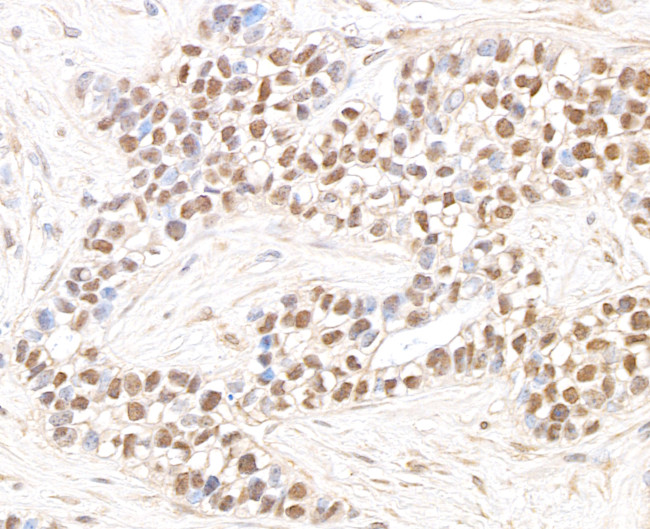 JHDM1A Antibody in Immunohistochemistry (Paraffin) (IHC (P))