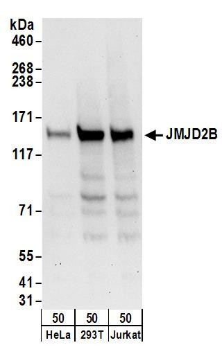 JMJD2B Antibody in Western Blot (WB)