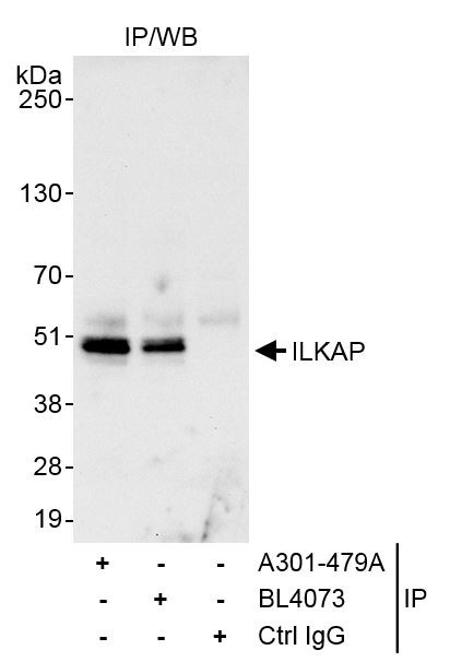 ILKAP Antibody in Immunoprecipitation (IP)