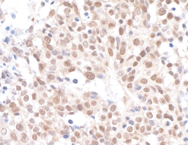 Caf1p150 Antibody in Immunohistochemistry (Paraffin) (IHC (P))