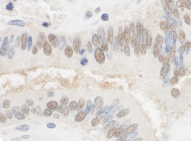 CSTF2T/TauCSTF64 Antibody in Immunohistochemistry (Paraffin) (IHC (P))