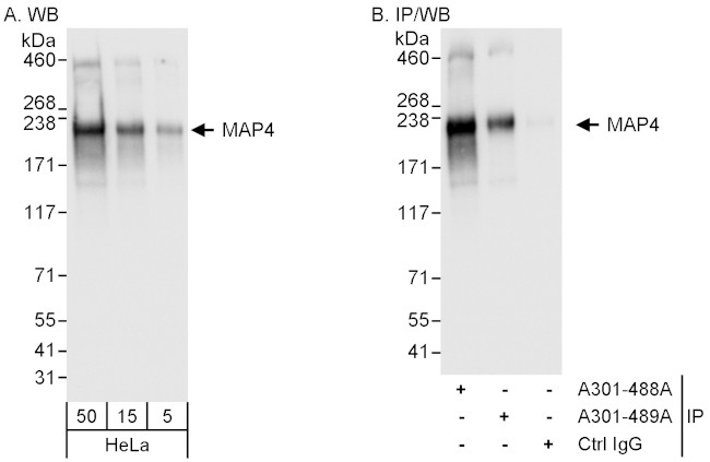 MAP4 Antibody in Western Blot (WB)