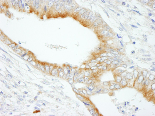 MAP7 Antibody in Immunohistochemistry (Paraffin) (IHC (P))