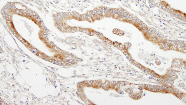 MAP7 Antibody in Immunohistochemistry (Paraffin) (IHC (P))