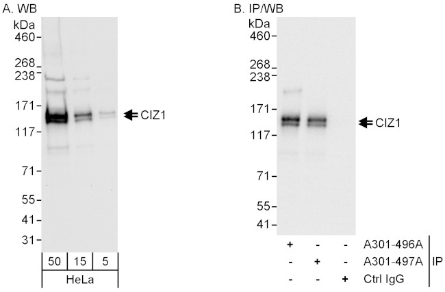 CIZ1 Antibody in Western Blot (WB)