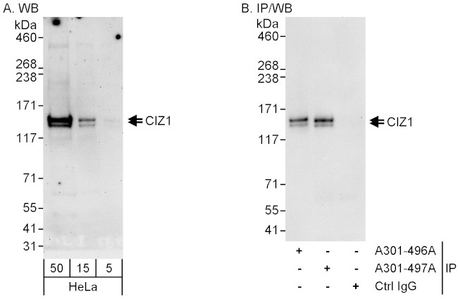 CIZ1 Antibody in Western Blot (WB)