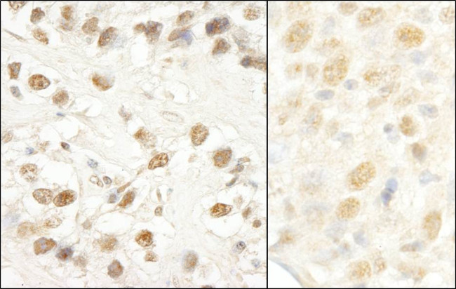 CROP/Luc7A Antibody in Immunohistochemistry (Paraffin) (IHC (P))