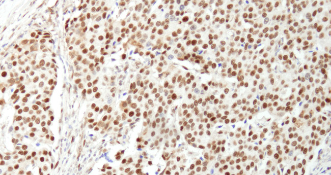 NUCKS Antibody in Immunohistochemistry (Paraffin) (IHC (P))