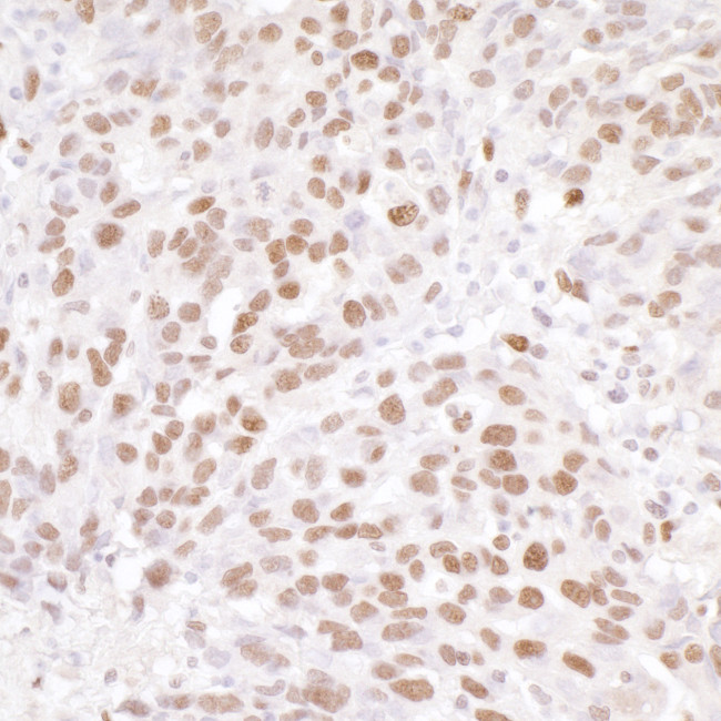 NUCKS Antibody in Immunohistochemistry (Paraffin) (IHC (P))