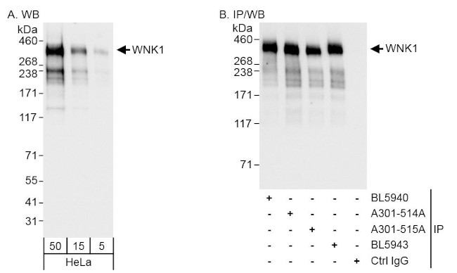 WNK1 Antibody in Western Blot (WB)