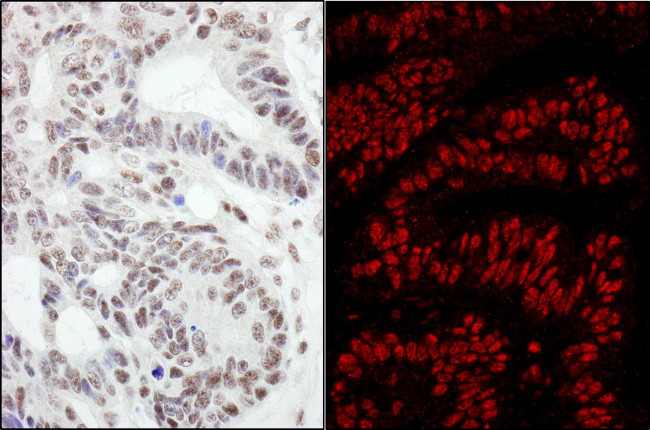 RanBP3 Antibody in Immunohistochemistry (Paraffin) (IHC (P))
