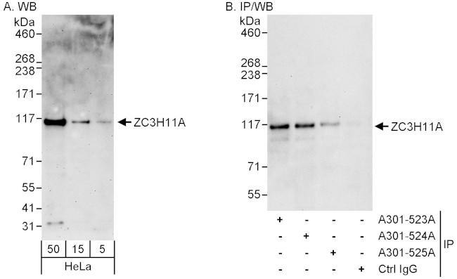 ZC3H11A Antibody in Western Blot (WB)