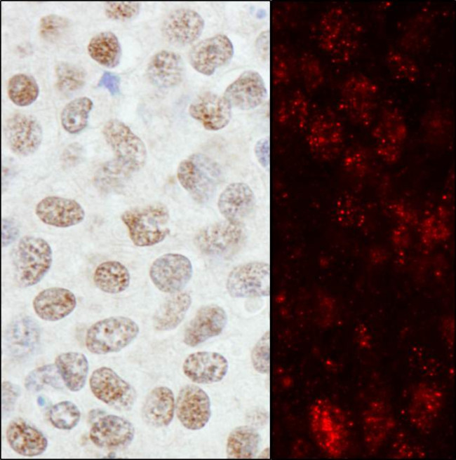 ZNF295 Antibody in Immunohistochemistry (Paraffin) (IHC (P))