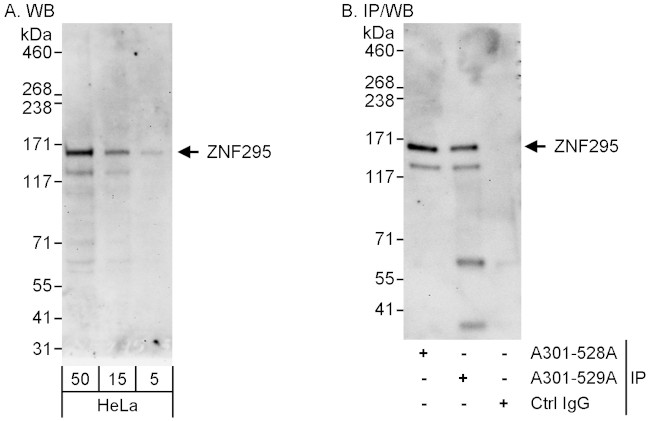 ZNF295 Antibody in Western Blot (WB)