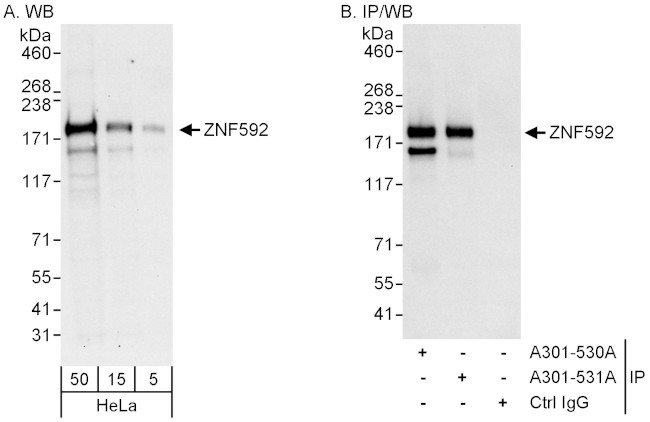 ZNF592 Antibody in Western Blot (WB)
