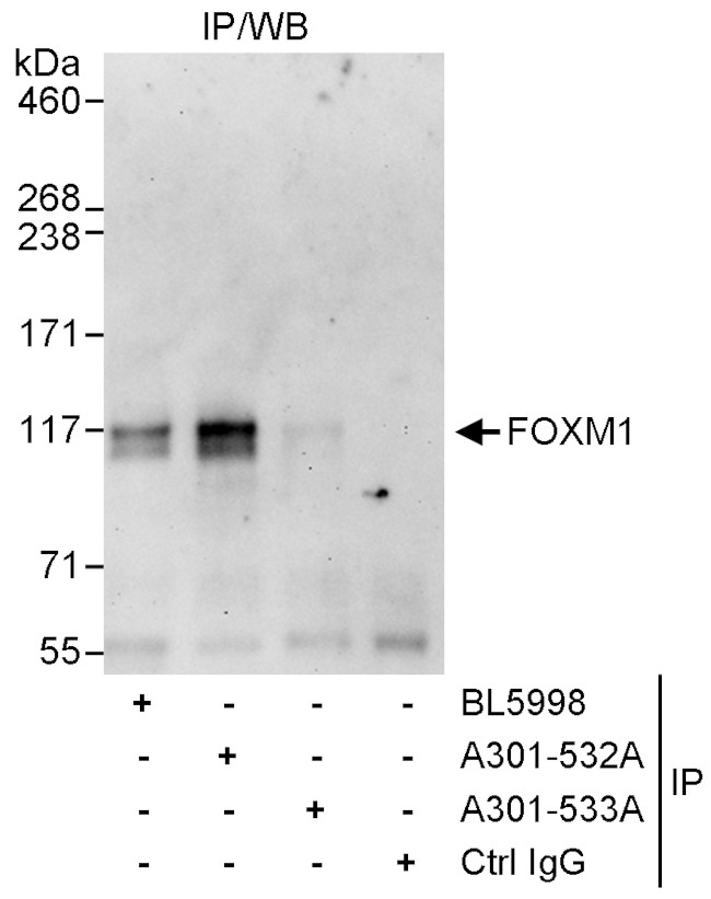 FOXM1 Antibody in Immunoprecipitation (IP)