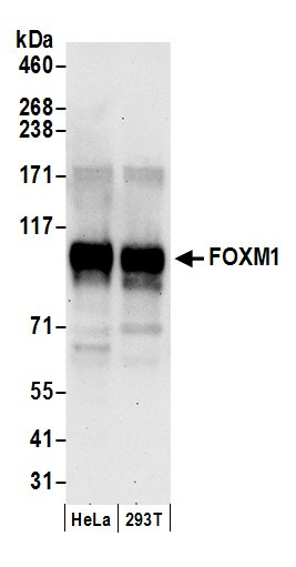 FOXM1 Antibody in Western Blot (WB)