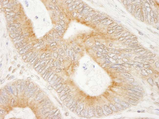 MAP7 Antibody in Immunohistochemistry (Paraffin) (IHC (P))